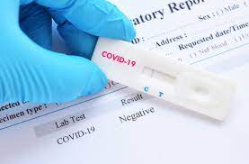 Tăng cưởng quản lý, xử lý nghiêm việc lợi dụng dịch bệnh tăng giá xét nghiệm Covid-19.